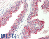 Anti-SLC45A3 / Prostein Antibody (N-Terminus) IHC-plus LS-B309