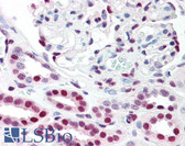 Anti-TP53BP1 / 53BP1 Antibody IHC-plus LS-B315