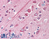 Anti-TUBB / Beta Tubulin Antibody (aa1-100) IHC-plus LS-B316