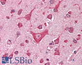 Anti-CAMK4 Antibody (aa305-323) IHC-plus LS-B335