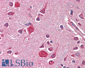 Anti-AGAP2 / PIKE Antibody (aa1-836) IHC-plus LS-B338