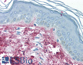 Anti-Collagen III Antibody (Biotin) IHC-plus LS-B339
