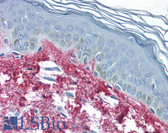 Anti-Collagen I Antibody IHC-plus LS-B342