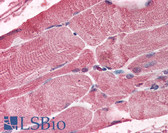 Anti-BMI1 / PCGF4 Antibody (aa252-264) IHC-plus LS-B346