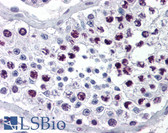 Anti-Cyclin A Antibody IHC-plus LS-B349
