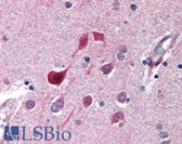 Anti-CDK5 Antibody (C-Terminus) IHC-plus LS-B353