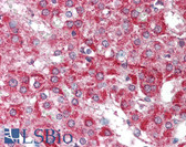 Anti-HUS1B Antibody (aa104-117) IHC-plus LS-B376