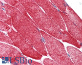 Anti-HSPB1 / HSP27 Antibody IHC-plus LS-B383