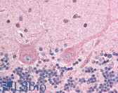 Anti-ING4 Antibody (aa164-175) IHC-plus LS-B386