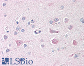 Anti-ISG15 Antibody IHC-plus LS-B388