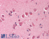 Anti-MAD2L1 / MAD2 Antibody (aa3-13) IHC-plus LS-B389