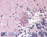 Anti-MAD2B / REV7 Antibody (aa3-14) IHC-plus LS-B390