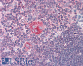 Anti-NFKB1 Antibody (N-Terminus) IHC-plus LS-B395