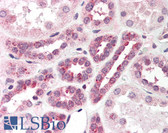 Anti-PNKP Antibody (Internal) IHC-plus LS-B404