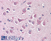 Anti-RFFL Antibody (aa1-363) IHC-plus LS-B416