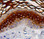 Cytokeratin 10 on human skin