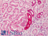 Anti-SPP1 / Osteopontin Antibody (N-Terminus) IHC-plus LS-B425