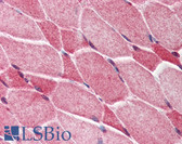 Anti-AES / Groucho Antibody (C-Terminus) IHC-plus LS-B441