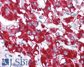 Anti-BAG1 / BAG-1 Antibody (N-Terminus) IHC-plus LS-B445