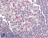 Anti-BCL2A1 Antibody (C-Terminus) IHC-plus LS-B450