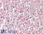 Anti-BCL2L1 / BCL-XL Antibody (C-Terminus) IHC-plus LS-B451