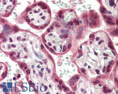 Anti-BCL2L13 / Bcl Rambo Antibody (Internal) IHC-plus LS-B453
