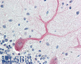 Anti-BIRC7 / Livin Antibody (aa264-280) IHC-plus LS-B456