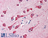 Anti-BAD Antibody (C-Terminus) IHC-plus LS-B461