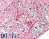 Anti-TIGAR Antibody (Internal) IHC-plus LS-B462