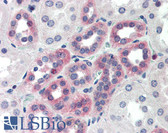 Anti-C1QTNF6 / CTRP6 Antibody (Internal) IHC-plus LS-B468