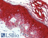 Anti-CASP14 / Caspase 14 Antibody (C-Terminus) IHC-plus LS-B474