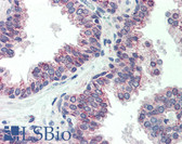 Anti-CBLN1 / Cerebellin 1 Antibody IHC-plus LS-B478