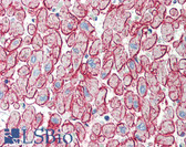 Anti-CDH13 / Cadherin 13 Antibody (N-Terminus) IHC-plus LS-B481