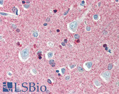 Anti-CRMP1 Antibody (C-Terminus) IHC-plus LS-B483