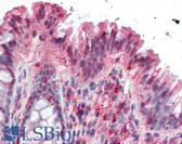 Anti-NOXO1 Antibody (aa238-252) IHC-plus LS-B485