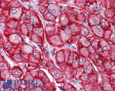 Anti-SCARB1 / SR-BI Antibody (aa450-509) IHC-plus LS-B497