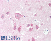 Anti-LRRK2 Antibody (aa2500-2527) IHC-plus LS-B505