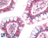 Anti-NPC1L1 Antibody (aa500-600) IHC-plus LS-B506
