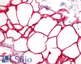 Anti-CD36 Antibody (aa100-200) IHC-plus LS-B508