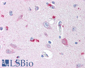 Anti-NPC / NPC1 Antibody (C-Terminus) IHC-plus LS-B509