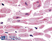 Anti-HIF2A / EPAS1 Antibody (C-Terminus) IHC-plus LS-B517