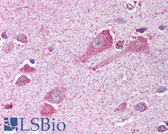 Anti-TRPM7 Antibody (C-Terminus) IHC-plus LS-B527