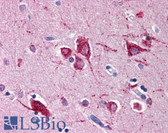 Anti-RHEB Antibody IHC-plus LS-B543