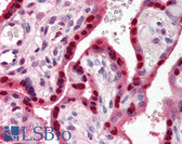 Anti-RYBP Antibody (aa215-228) IHC-plus LS-B546