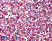 Anti-SEPT4 / Septin 4 Antibody (N-Terminus) IHC-plus LS-B549