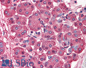 Anti-SKI Antibody (N-Terminus) IHC-plus LS-B552
