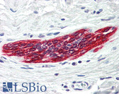 Anti-DAPK2 / DAP Kinase 2 Antibody (C-Terminus) IHC-plus LS-B556