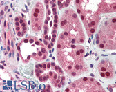 Anti-DFFB Antibody (Internal) IHC-plus LS-B559