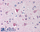 Anti-IL27RA / WSX-1 Antibody (aa44-59) IHC-plus LS-B574