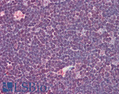 Anti-IL31 Antibody (Internal) IHC-plus LS-B575